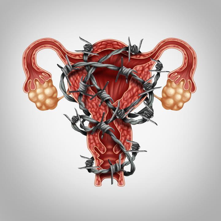 Adenomyosis